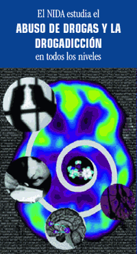 Imagen de un cerebro que dice &quot;El NIDA estudia el abuso de drogas y la drogadiccin en todos los niveles.&quot;